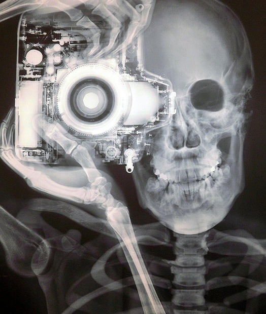 X-ray photo X ray Image of a Nikon Photographer xray mini