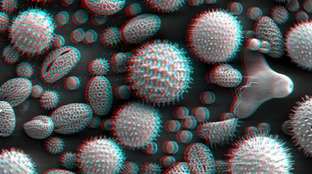 3delectronmicroscope_mini