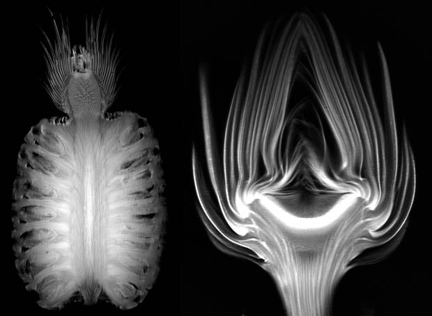 mri
