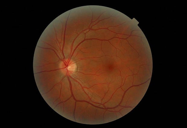 retina